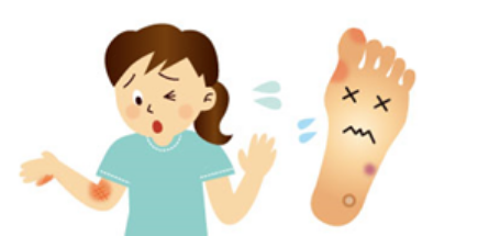 皮膚科 よくある症状