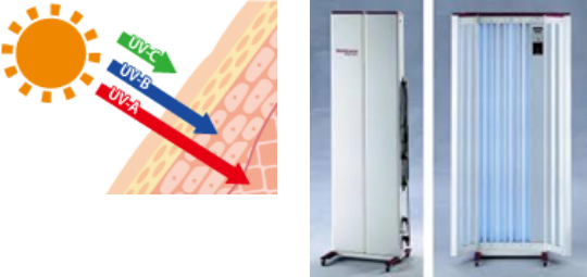 ナローバンドUVB照射器